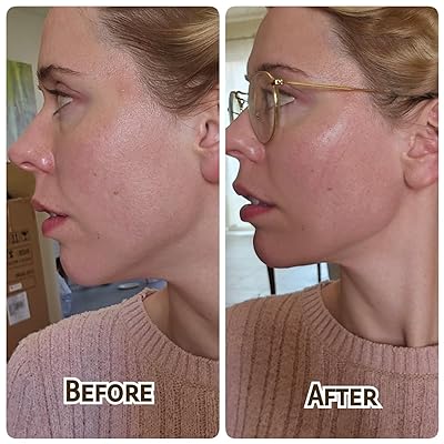 ContourSculpt Face Shaper