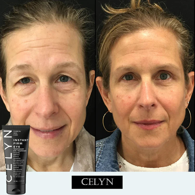 CELYN: Instant Firming Magic