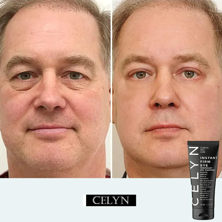 CELYN: Instant Firming Magic